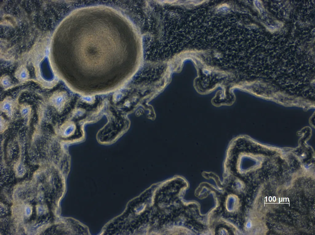K-rhaeticus_microscopy_Pevere_16-1024x765