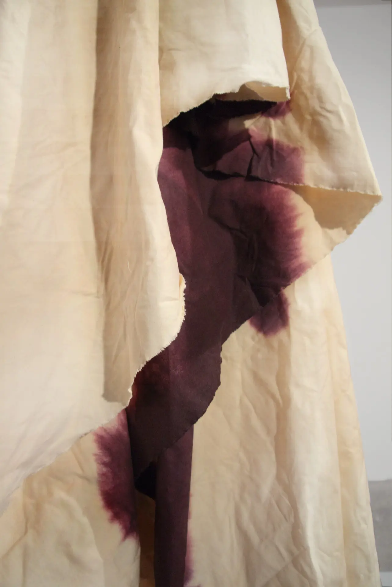 Lymph_09